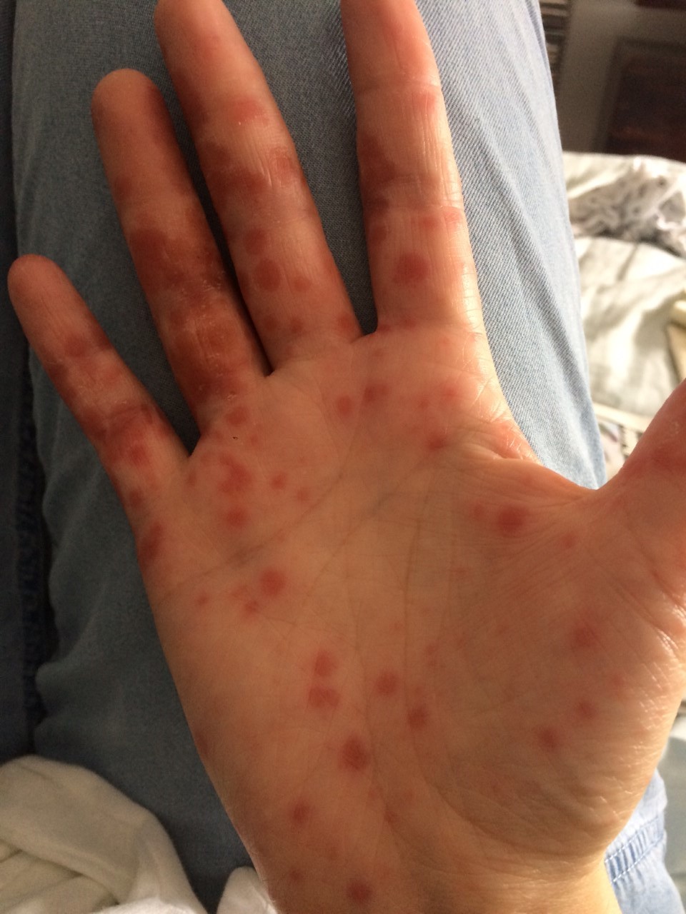 Hands Bad